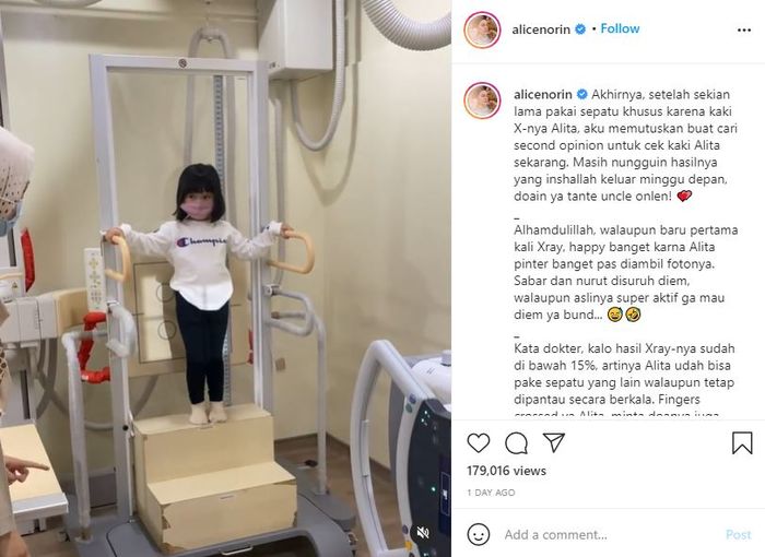 Alice Norin saat mendampingi anaknya yang menjalani pemeriksaan kaki X. 