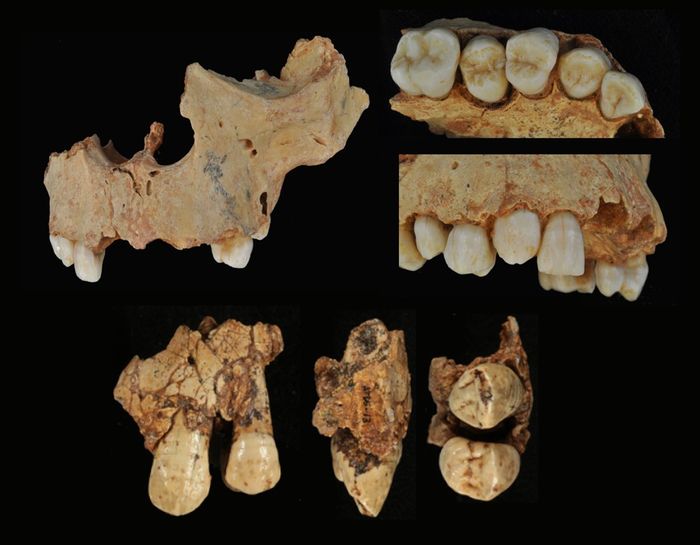 Rahang gigi Gadis dari Gran Dolina yang merupakan Homo antecessor di Spanyol.