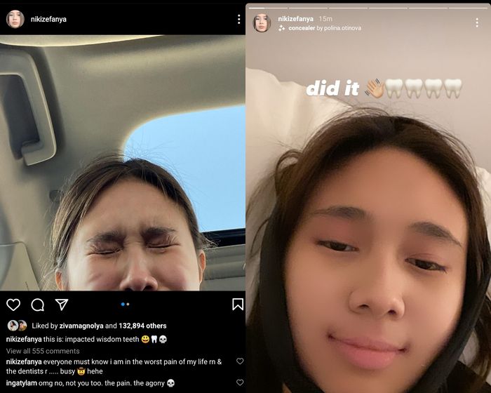 Kolase foto tangkapan layar Instagram Niki Zefanya.