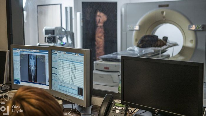 Mumi mesir kuno yang meninggal dalam kondisi hamil itu sedang menjalani pemindaian dengan CT tomografi.