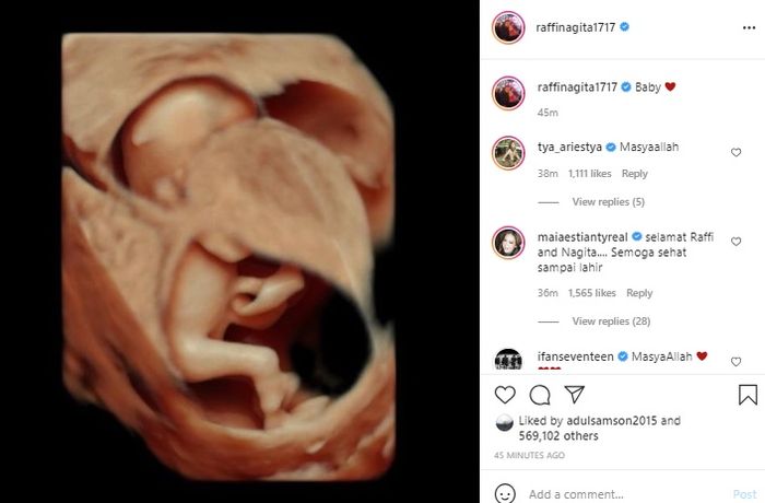 Unggahan Raffi Ahmad dan Nagita Slavina mengenai hasil USG anak keduanya