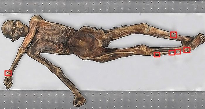 Ötzi the Iceman, pemilik tato tertua, memiliki tato di beberapa titik pada lengan dan betisnya. Tato pada tubuh Otzi dibuat dengan menyayat kulit, lalu menggosokkan arang pada rongganya; dapat dilihat pada kotak merah pada gambar.