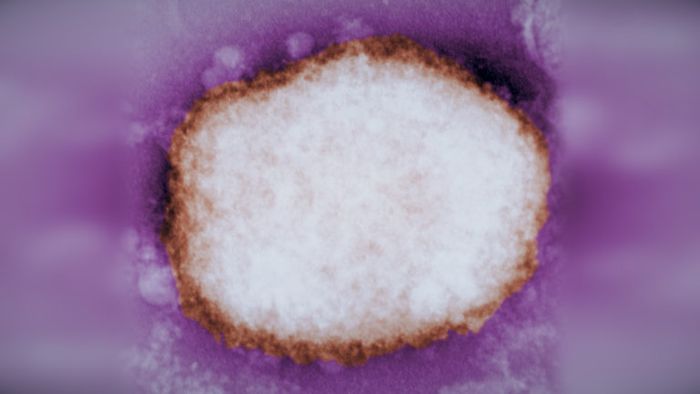 Partikel dalam virus cacar monyet.
