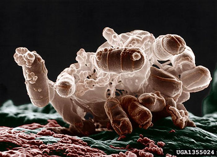 Proteobacteria ini bernama Escherichia coli, yang difoto dengan mikrograf elektron suhu rendah berwarna dari sekelompok bakteri. Bakteri individu dalam foto ini berbentuk lonjong dan berwarna coklat. Ucapan Terima Kasih Foto milik InsectImages.org. Pewarnaan oleh Christopher Pooley.