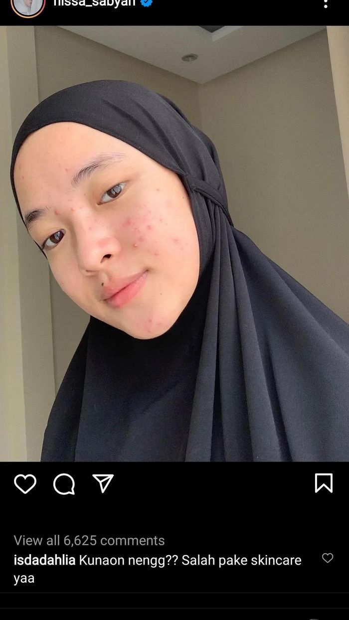 Komentar Iis Dahlia yang menanyakan muka Nissa Sabyan.