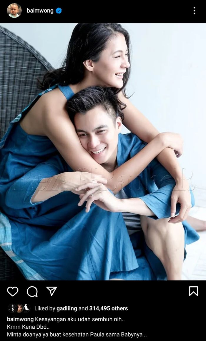 Unggahan Baim Wong tentang kondisi kesehatan Paula Verhoeven setelah dirawat di rumah sakit.