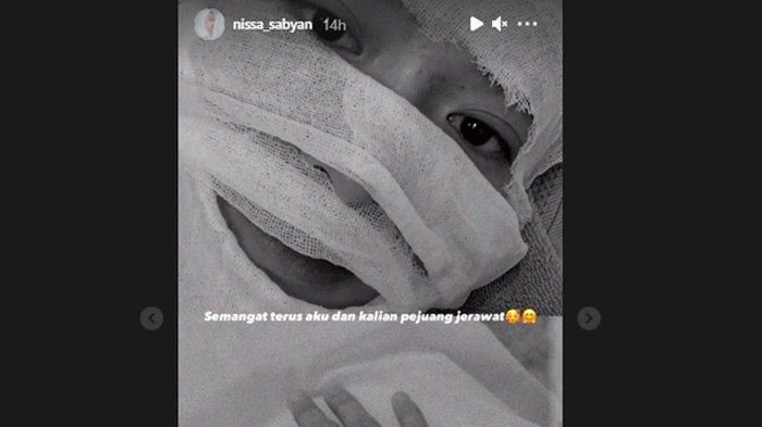 Wajah Nissa Sabyan terbalut perban kecuali bagian mata, sedikit hidung serta bibir.