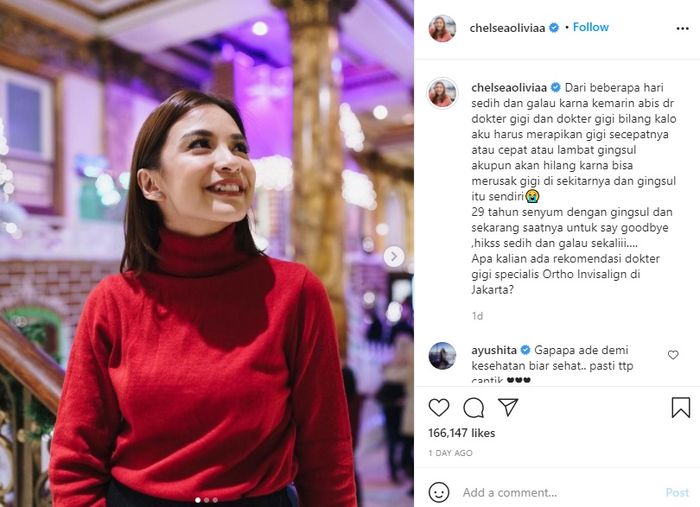 Unggahan Chelsea Olivia saat menjelaskan kondisi gigi gingsulnya.