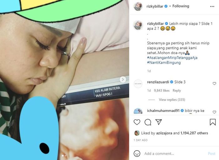 Rizky Billar mengunggah hasil usg calon buah hatinya dan Lesti Kejora  