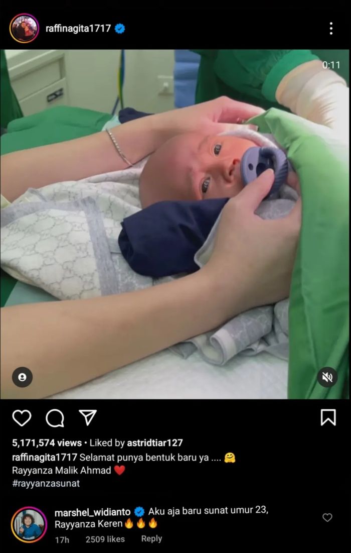 Komentar Marshel Widianto di unggahan Rayyanza Malik Ahmad yang sedang disunat di Instagram Raffi Ahmad dan Nagita Slavina.