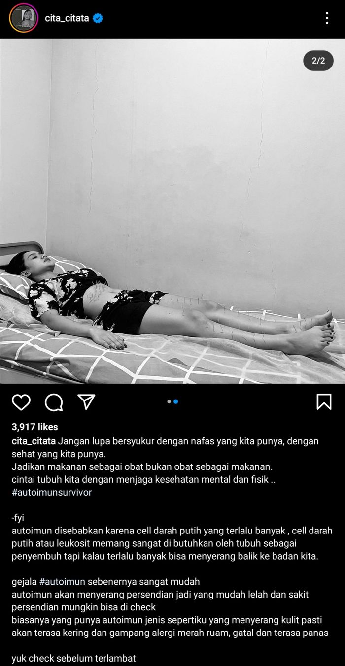 Unggahan CIta Citata yang sedang menjalani pengobatan alternatif.