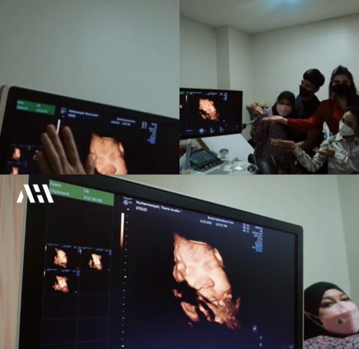 Aurel Hermansyah jalani pemeriksaan jelang melahirkan