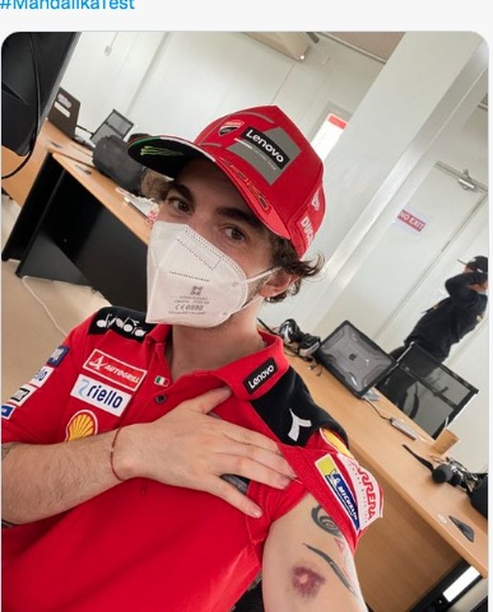 Pembalap Ducati Lenovo Team, Francesco Bagnaia, menunjukkan luka memar di tangan usai terkena kerikil saat Tes Pramusim MotoGP Mandalika.