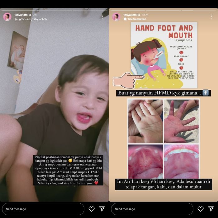 Unggahan Tasya Kamila yang memperlihatkan gejala flu Singapura yang dialami anak pertamanya.