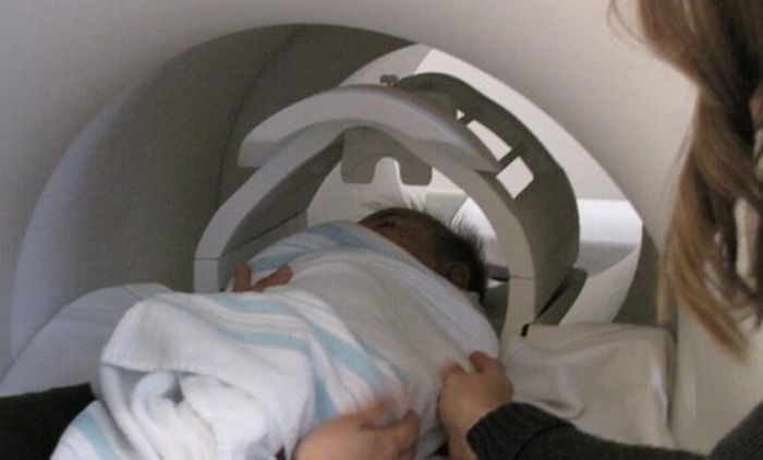 Bayi saat dilakukan pemindaian MRI.