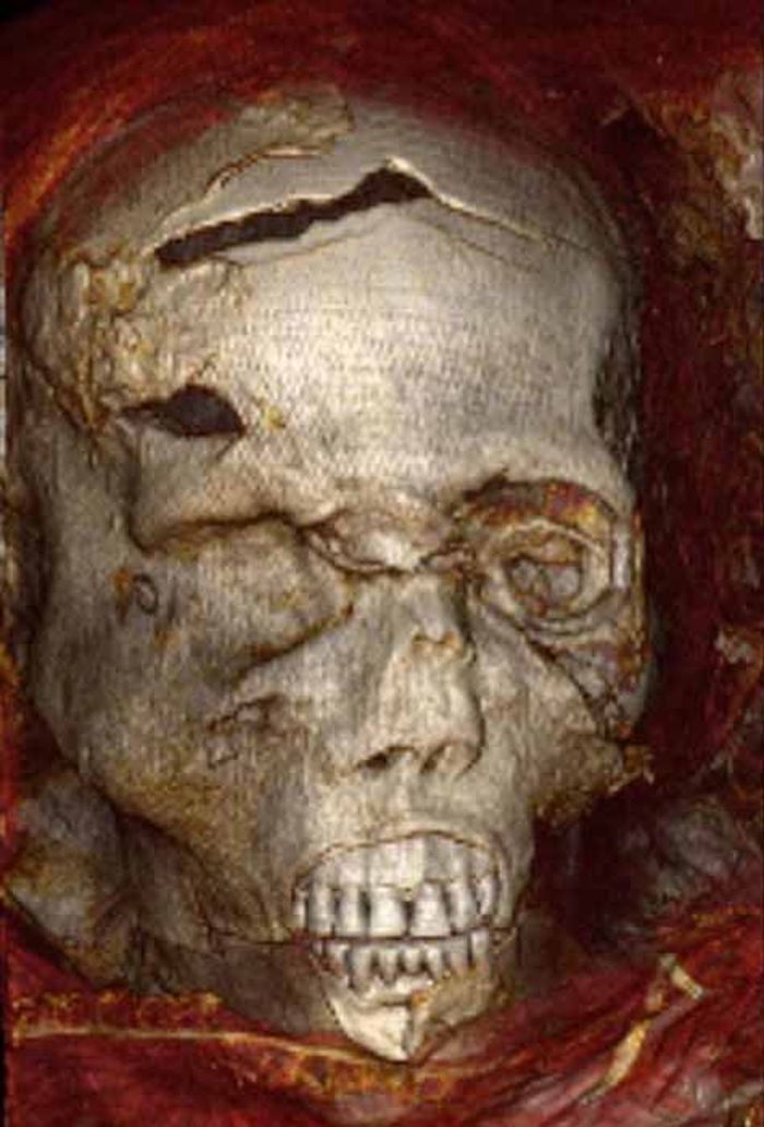 Luka-luka di kepala Firaun Seqenenre Tao II berdasarkan hasil pemeriksaan CT scan.