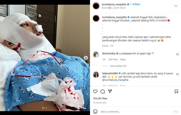 Unggahan Instagram Lucinta Luna Oplas Lagi.