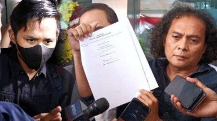 Deolipa Yumara pengacara Bharada E 