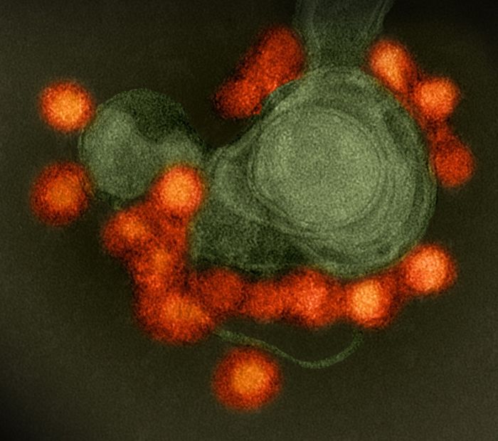 Gambar mikroskop elektron transmisi virus Zika (merah).