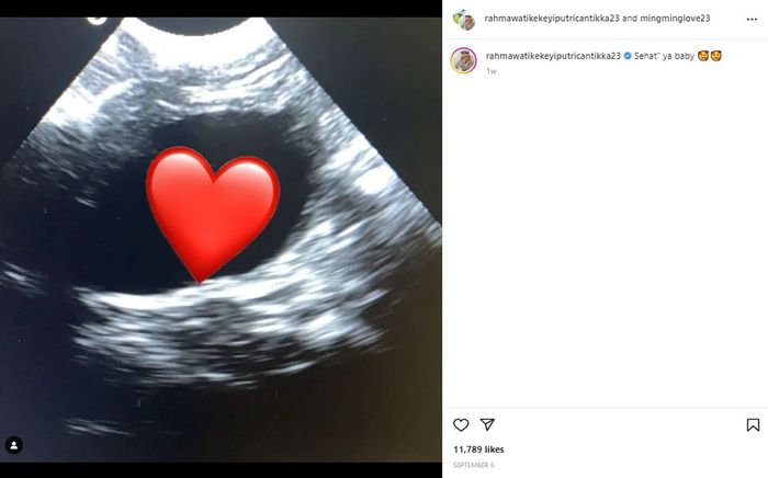 Foto hasil USG yang diunggah Kekeyi.