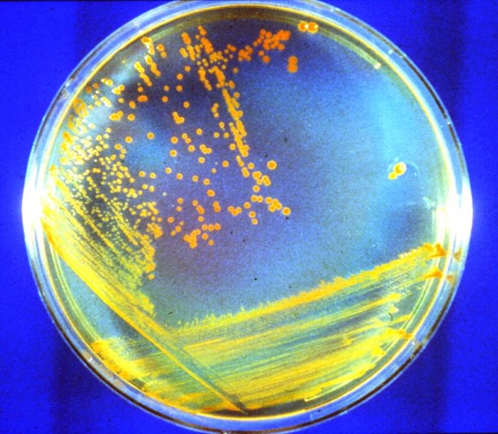 Deinococcus radiodurans, bakteri terkuat yang cocok dengan kondisi planet Mars.
