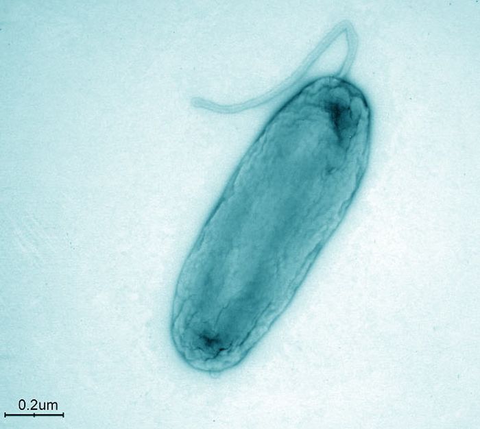 Legionella bononiensis, perbesaran 20 ,000x
