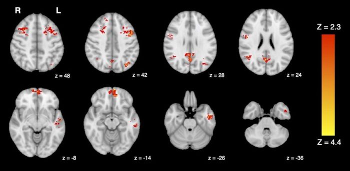 fMRI menunjukkan penurunan konektivitas fungsional di otak setelah terpapar polusi lalu lintas.