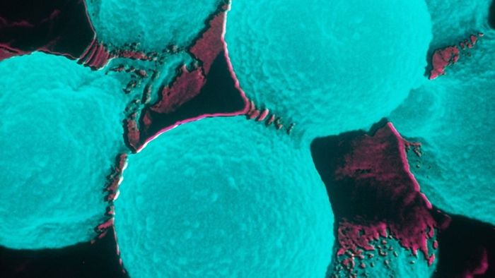 Kebanyakan orang yang terpapar cryptococcus neoformans tidak akan sakit, tetapi ada juga beberapa yang sakit. Namun bagaimana jika jamur ini bermutasi?