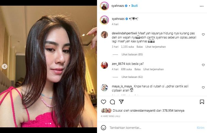 Syahnaz Sadiqah diduga jalani operasi plastik