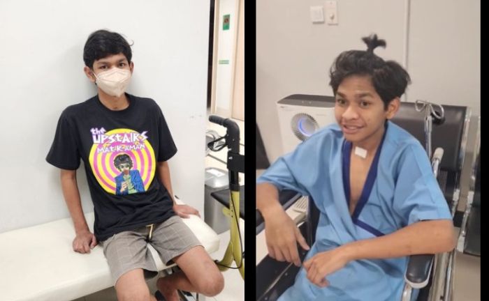 Begini kondisi terkini David Ozora setelah diizinkan pulang ke rumah.