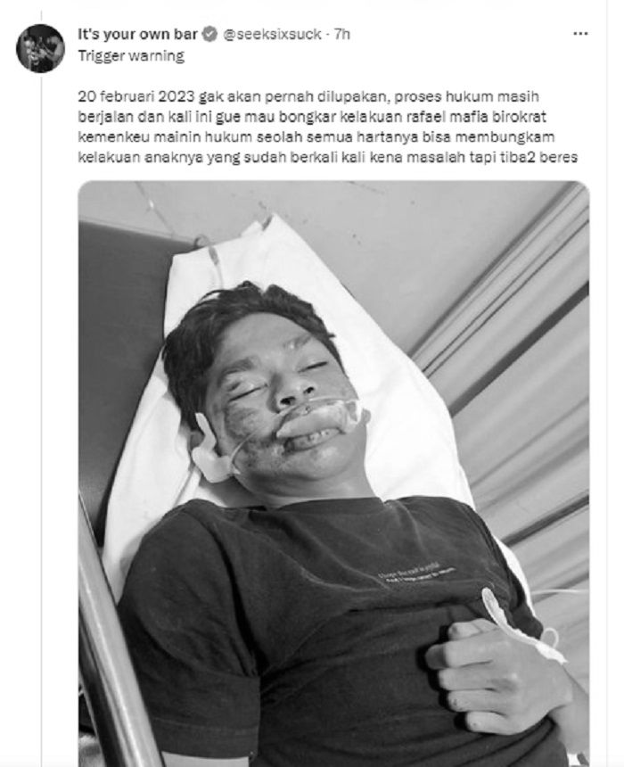 Kondisi David Ozora usai dianiaya Mario Dandy diungkap Jonathan Latumahina.