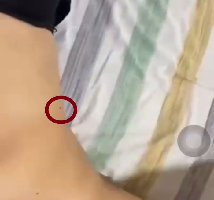 Tahi lalat diduga mirip Rebecca Klopper.