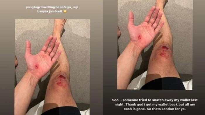 Afgan jadi korban jambret