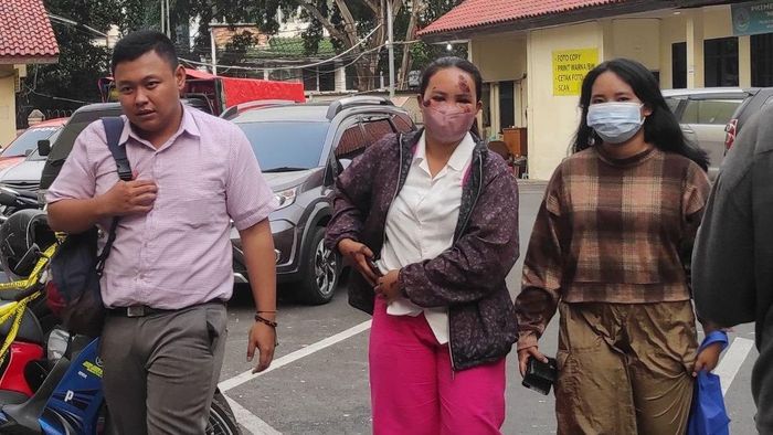 Wanita bernama Dyah Ambar Wulan (22) didampingi saudaranya mendatangi Polres Metro Jakarta Selatan di Kebayoran Baru, Jakarta Selatan, Minggu (4/6/2023), untuk membuat laporan kepolisian usai dirinya diduga ditabrak pacar sendiri.