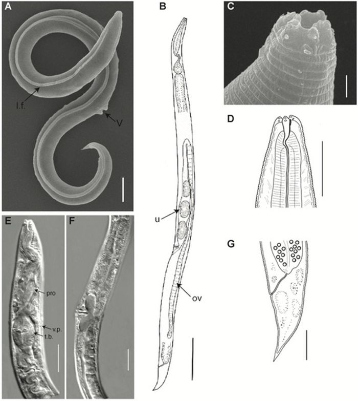 Morfologi umum spesies baru di dunia hewan P. kolymaensis, betina. Hasil pindai gambar elektron (A, C), foto mikroskop cahaya (E, F) dan presentasi grafik (B, D, G). Holotipe: A, B) seluruh tubuh, C, D) ujung anterior, E) tubuh anterior, F ) daerah tubuh perivulva, G) ekor.