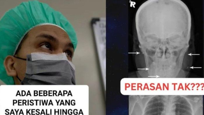 Pilu seorang wanita yang menderita kelumpuhan pada separuh tubuhnya, dokter syok menemukan empat susuk setelah lihat hasil rontgen