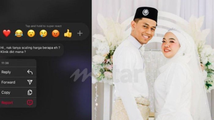 Pria nikahi dokter gigi, modus tanya harga scalling gigi.