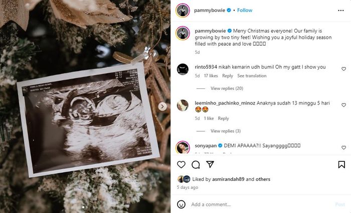 Pamela Bowie umumkan kehamilan anak pertamanya