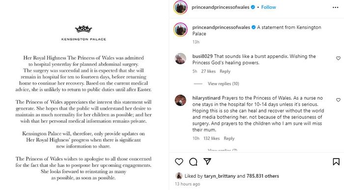 Pengumuman Kensington Palace terkait operasi Kate Middleton