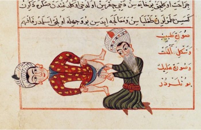 Ilustrasi kastrasi yang dibuat oleh dokter Persia abad ke-15, Syarafiddin Ali' Yazdi.