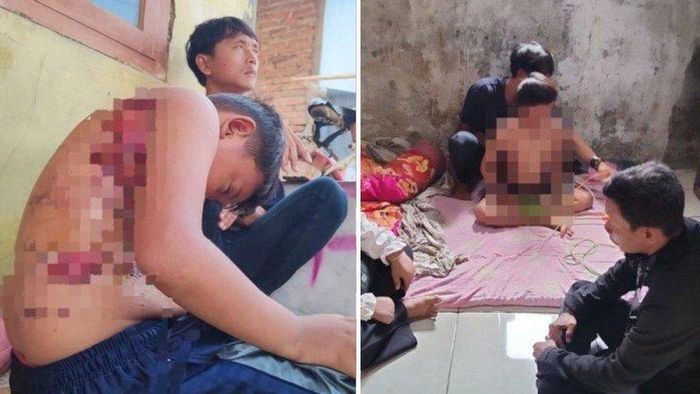 Kondisi AS usai mendapatkan perlakukan kekerasan dari sang buyut