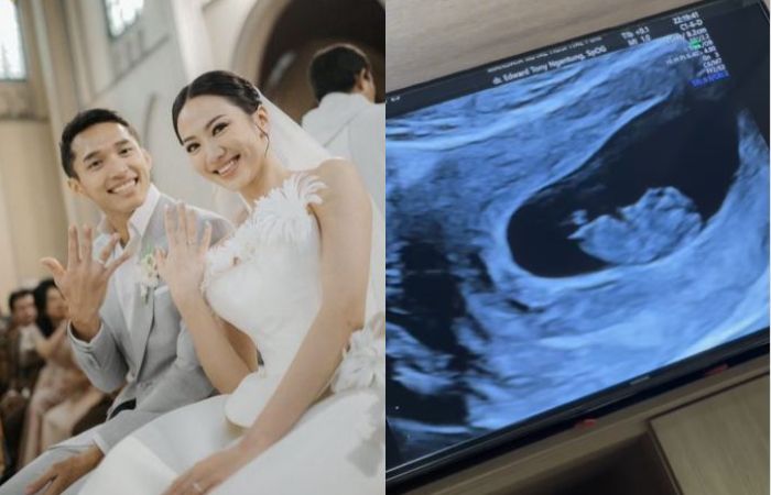 Pasangan Shanju dan Jonatan Christie umumkan kehamilan anak pertama