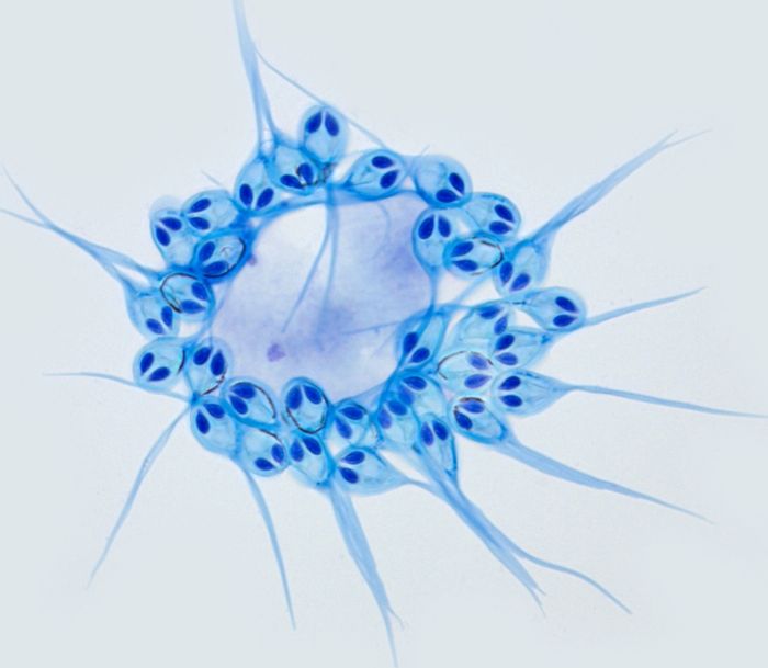 Henneguya salminicola