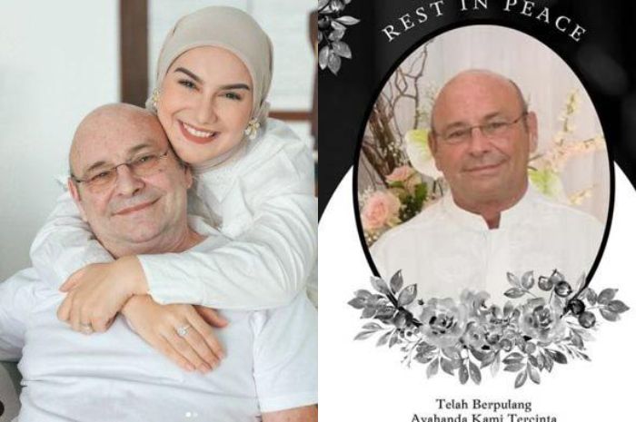 Ayah Irish Bella Meninggal Dunia, ini Potret Terakhirnya dengan Sang Putri Sebelum Hembuskan Napas Terakhir