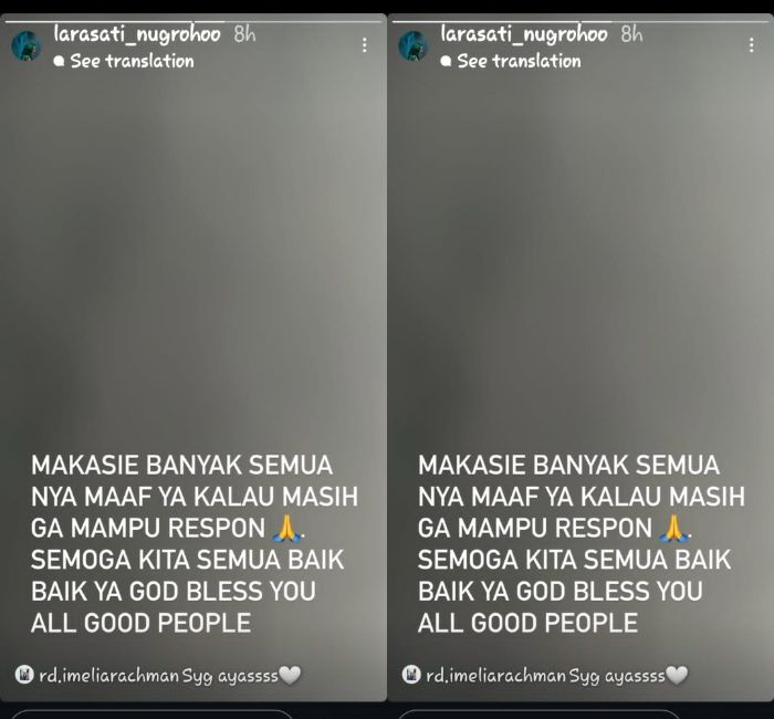Larasati Nugroho buka suara pasca alami kecelakaan.