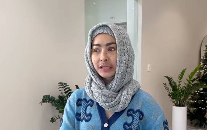 Kondisi Iis Dahlia beberapa hari pasca lakukan operasi plastik di Korea.