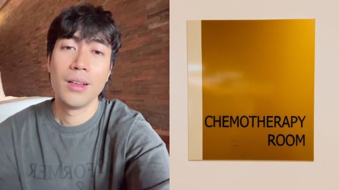 Vidi Aldiano niatkan berhenti kemoterapi