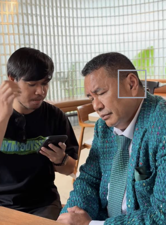 Hotman Paris memakai alat bantu pendengaran pada kedua telinganya.