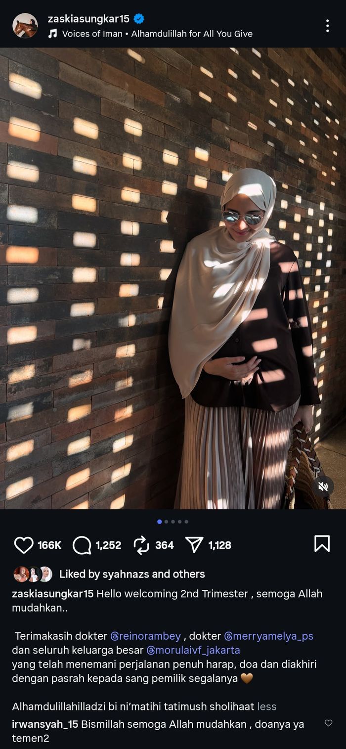 Zaskia Sungkar hamil anak kedua, Irwansyah mohon doa.