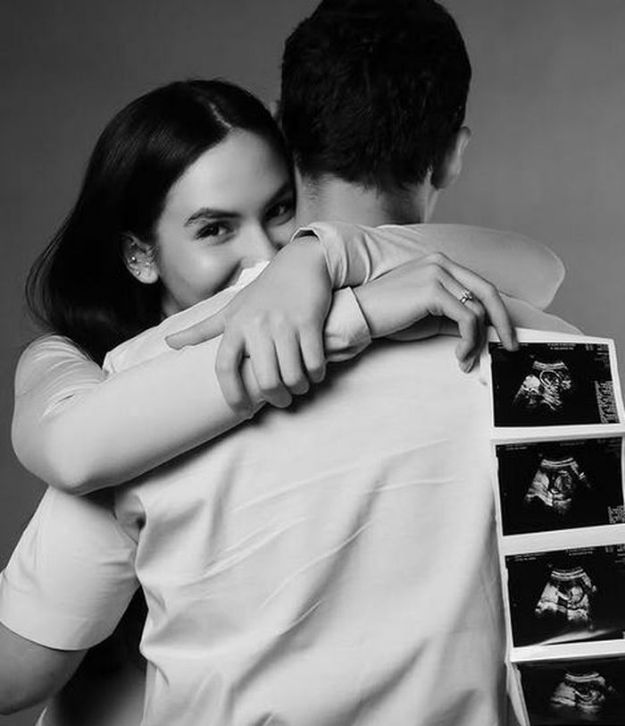 Steffi Zamora memperlihatkan foto janin dari hasil pemeriksaan USG.